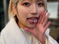 街角で声をかけて口内観察させてもらう はるのちゃん