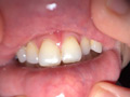 よだれダラダラすずちゃんの口内観察