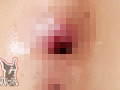アナル研究所 女の尻穴に詰め込み実験 肛門崩壊！！