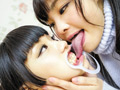 粘膜密着レズベロキス