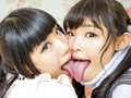 粘膜密着レズベロキス