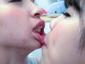 粘膜密着レズベロキス