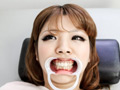 歯舐めレズ