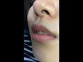 Mr.内科医の秘蔵コレクション（その10 後編）お嬢様