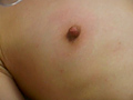 美乳吸引クリニック
