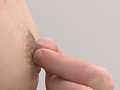 陥没乳首コンプレックス