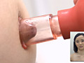 陥没乳首コンプレックス