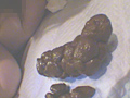悩める天然女子大生の糞日記