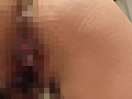 看護師をしている憧れの同級生と入院中にSEX