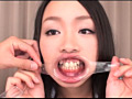 美しい女たちの口腔内観察