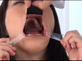 美しい女たちの口腔内観察