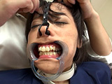 美人鼻フック ブサイク改造ビフォーアフター