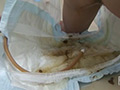 失禁病棟 おもらし治療SM 思春期病棟
