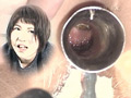 肛門直下2（7台マルチカメラ収録）