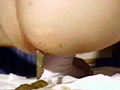 検便