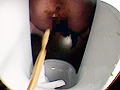 おしりの穴 おしりの穴から出てくる物編