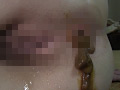 逝糞3