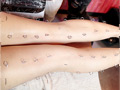 Beauty From Pain 施術動画