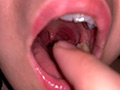 水沢つぐみの喉奥責め 腫れ気味な扁桃腺を…