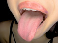 【個人撮影】笠木いちかの口内観察