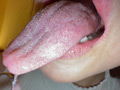 【個人撮影】赤城穂波の舌ブラシで「汚舌苔」採取