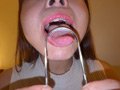 【個人撮影】赤城穂波の舌ブラシで「汚舌苔」採取