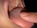 谷田かりな 開口器で口内観察デカ舌を要チェック