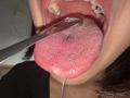 【個人撮影】湊波流の舌ブラシで「汚舌苔」採取！