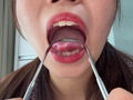 【個人撮影】水月みおの舌ブラシで「汚舌苔」採取