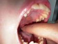 【個人撮影】水月みお初喉チンコ触り＆舌や八重歯を観察