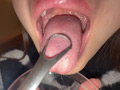 【個人撮影】さくまつなの舌ブラシで「汚舌苔」採取