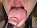 【個人撮影】音羽美鈴の舌ブラシで「汚舌苔」採取 サンプル画像4