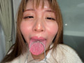 【個人撮影】宮ノ木しゅんかの舌ブラシで「汚舌苔」採取 サンプル画像5