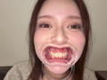 【個人撮影】彩川ゆめの喉チン触り＆開口器Wピース サンプル画像3